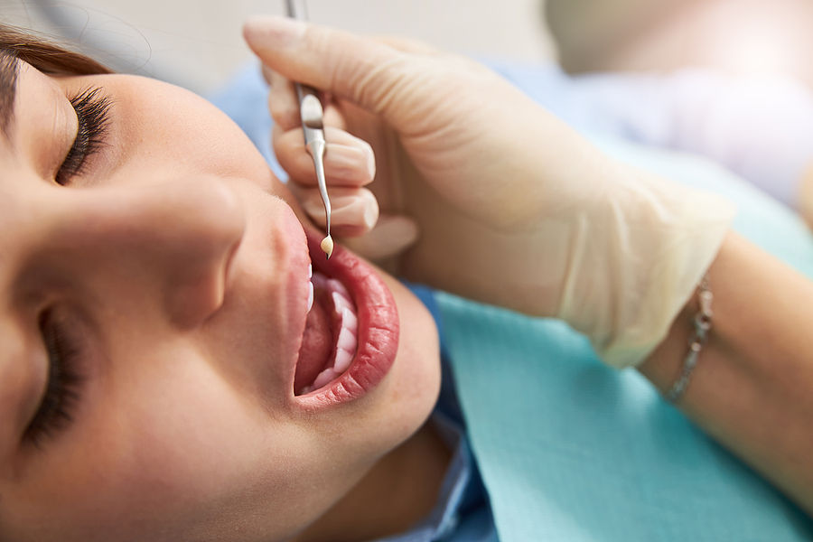 Why Routine Dental Checkups Matter More Than You Think