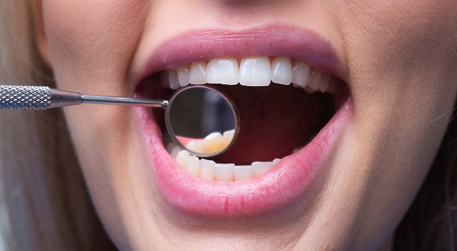 How Restorative Dentistry Can Improve Your Quality of Life